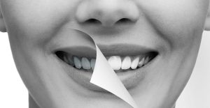 Dientes amarillos
