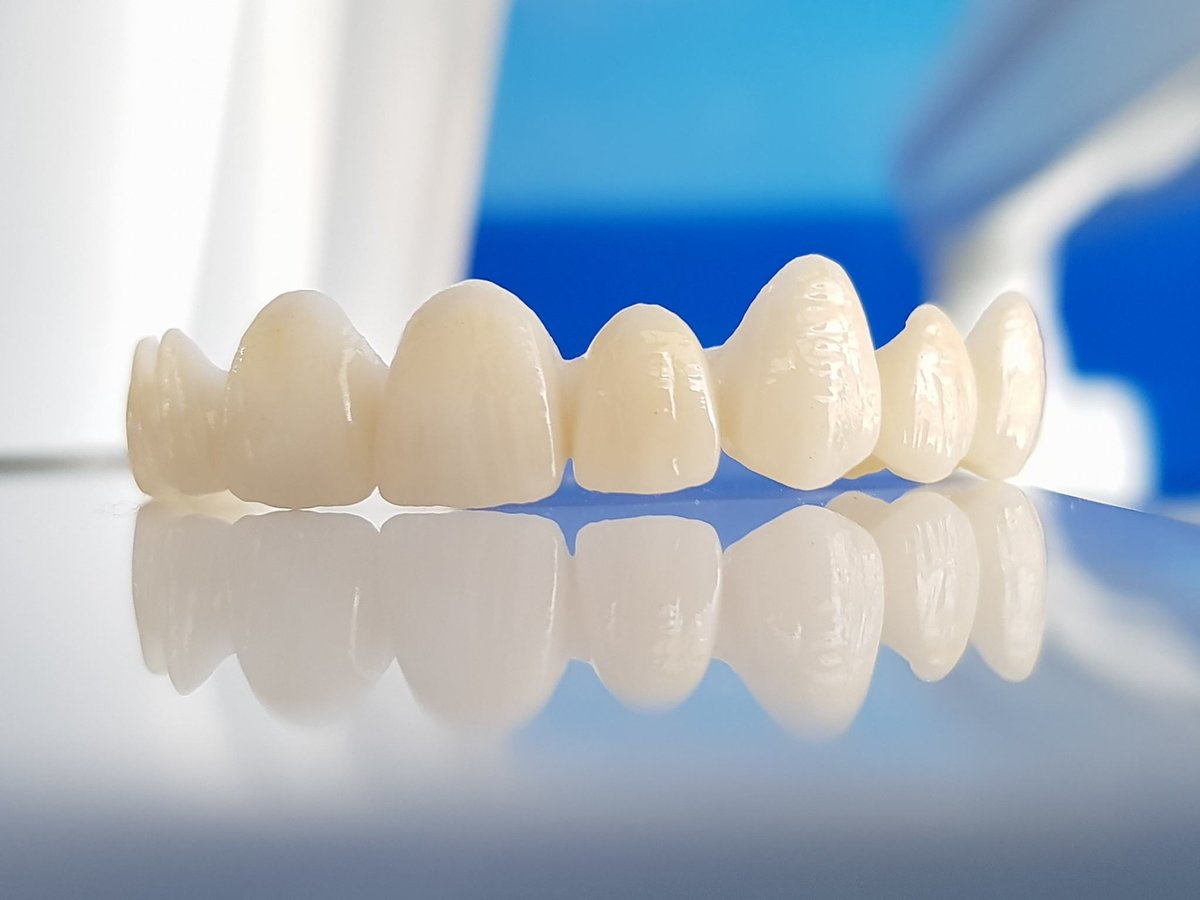 10 ventajas de las coronas de zirconio