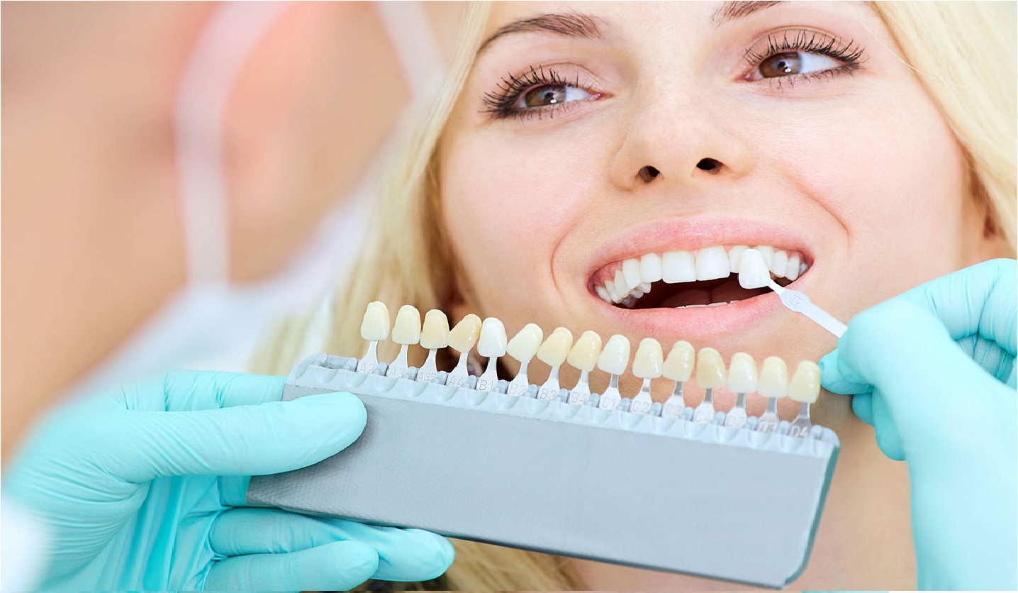 Prótesis dental precio