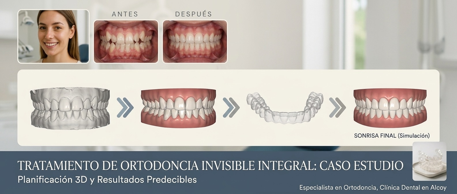 ortodoncia invisble antes y despues vitalcoy