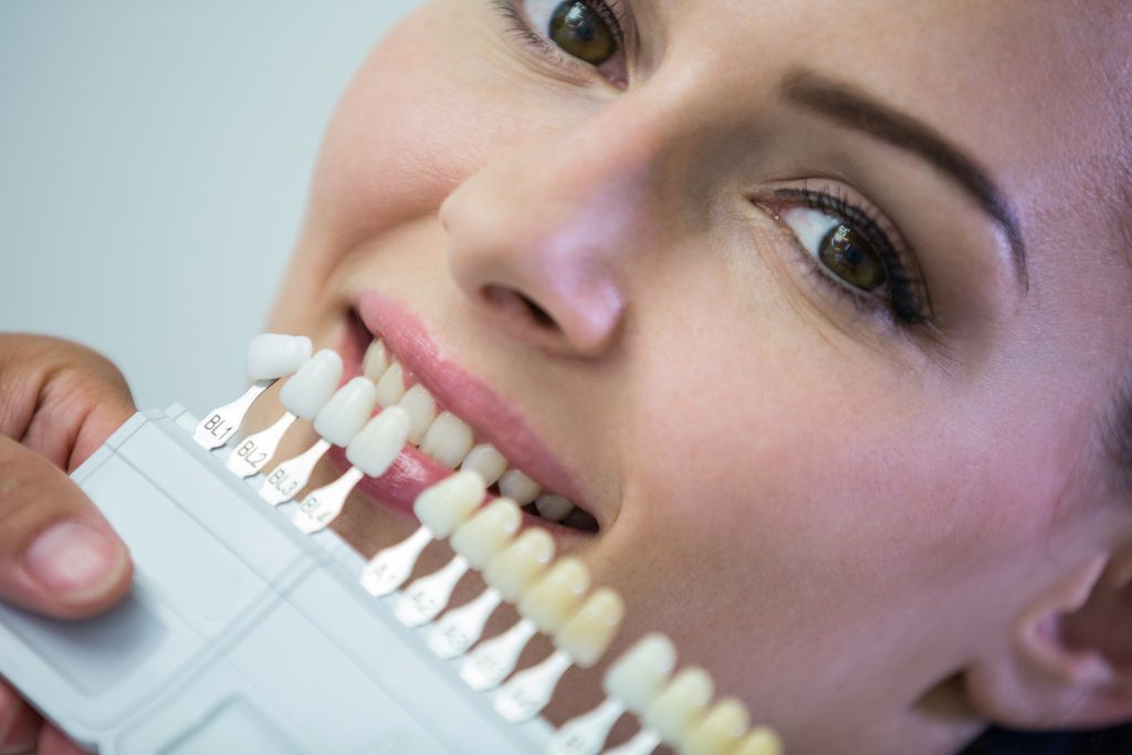 Comprobacion del tono dental en la consulta