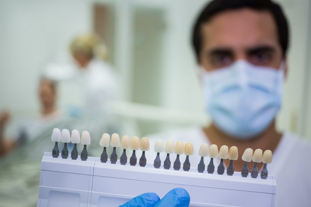Guia de color dental en la mano del profesional