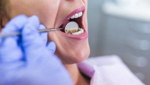 Infección dental: Síntomas y tratamientos