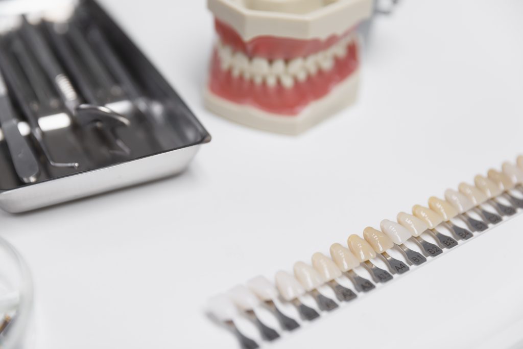 Modelo de dentadura y guia de color sobre la mesa