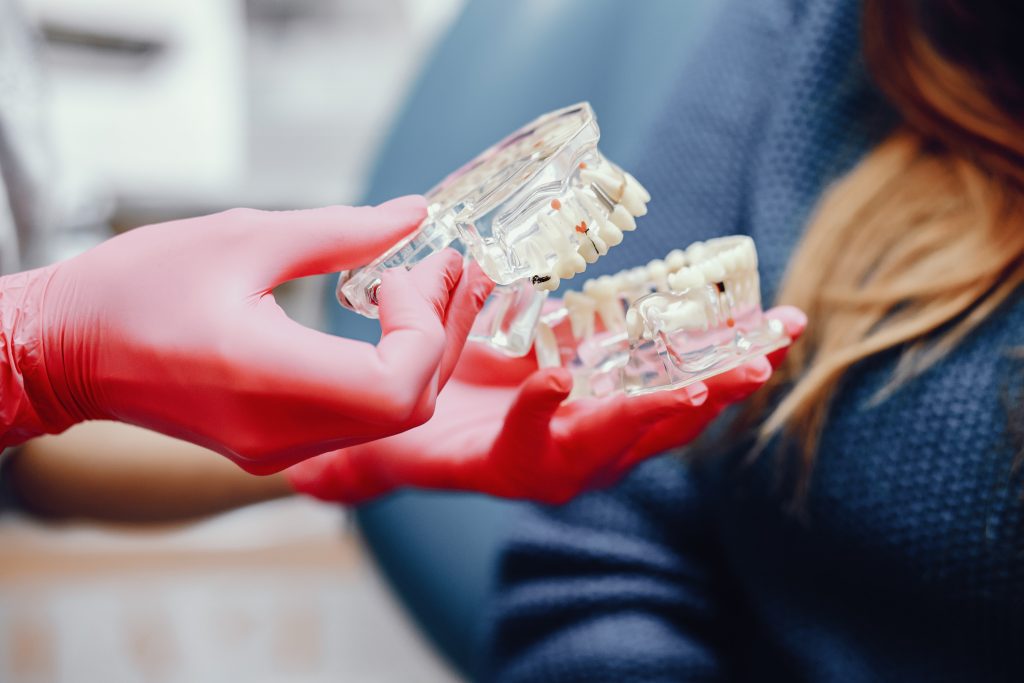 Maqueta de arcada dental en el gabinete