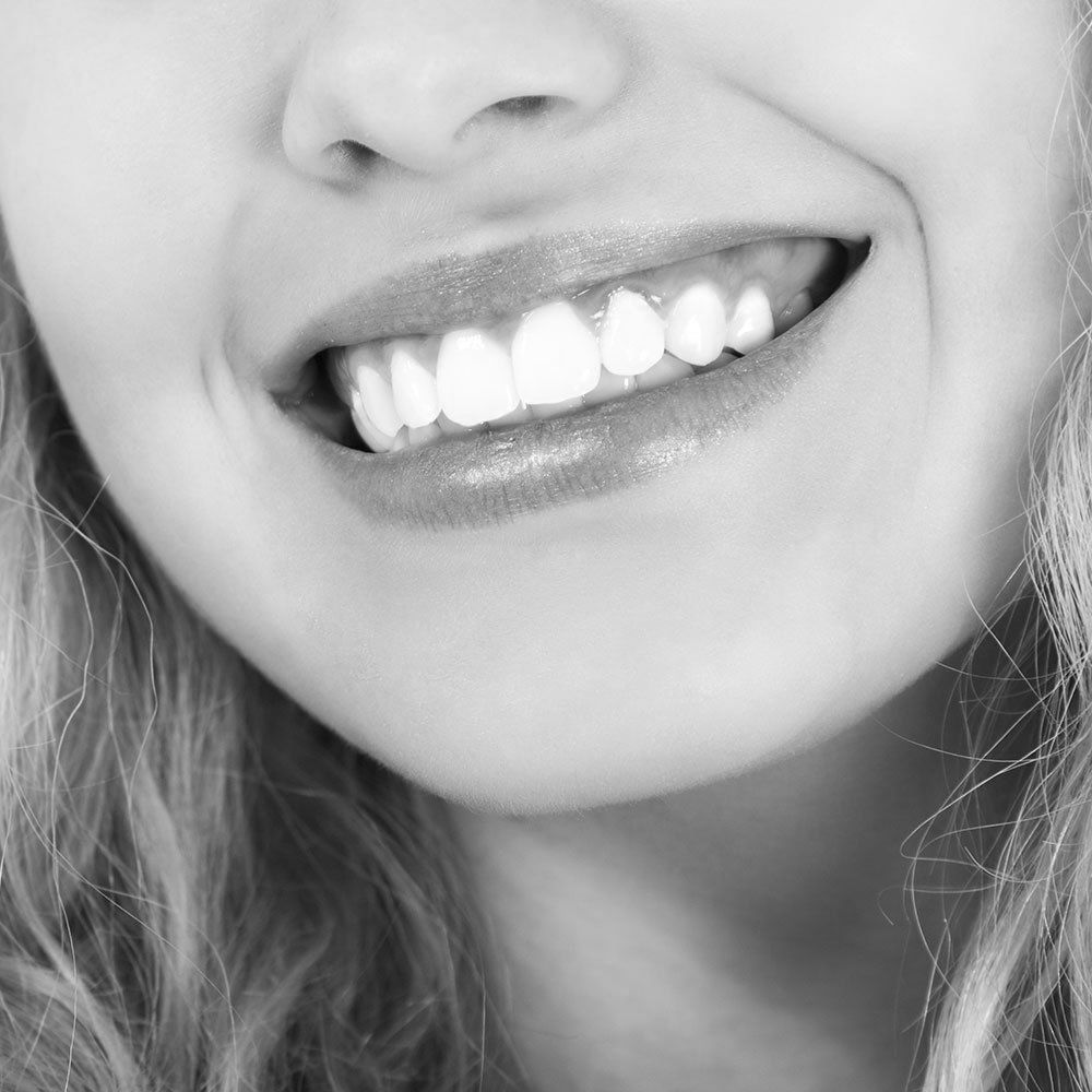 Blanquear los dientes: 7 motivos para hacerlo