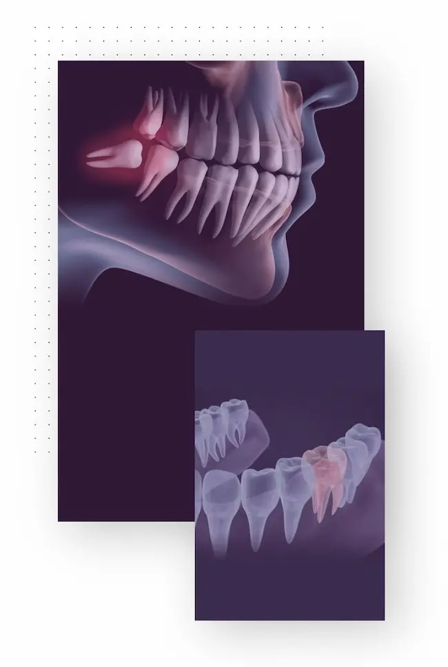 Visualización digital tridimensional de una boca